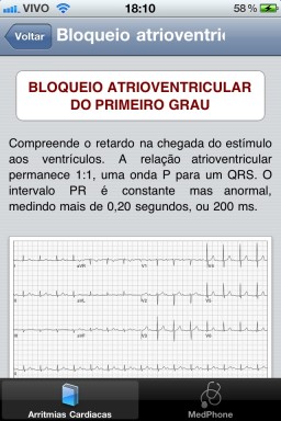 Arritmias Cardíacas - iPhone