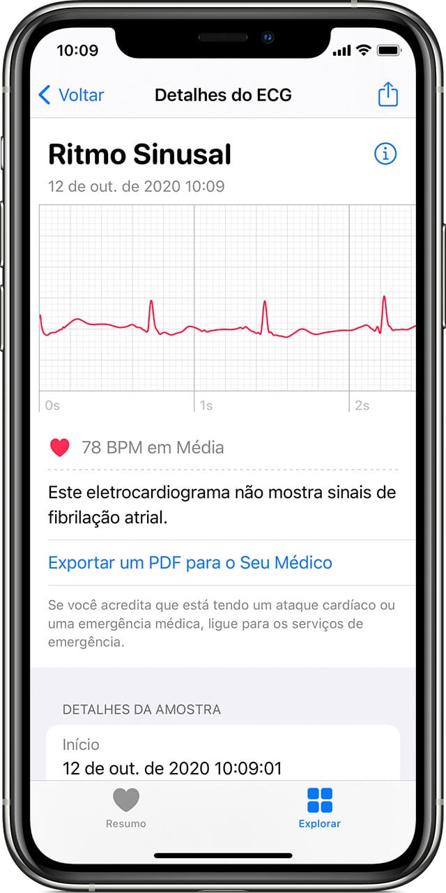 Apple confirma que ECG do Apple Watch será liberado no Brasil com watchOS  6.2.8