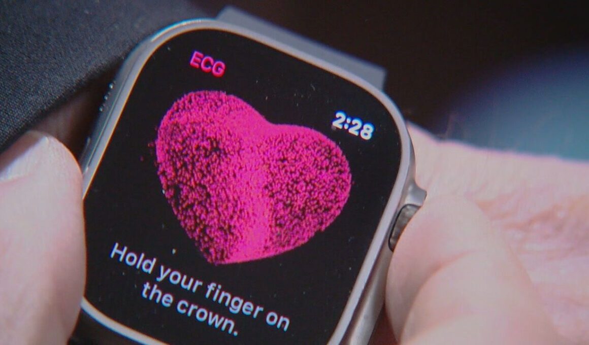 ECG do Apple Watch