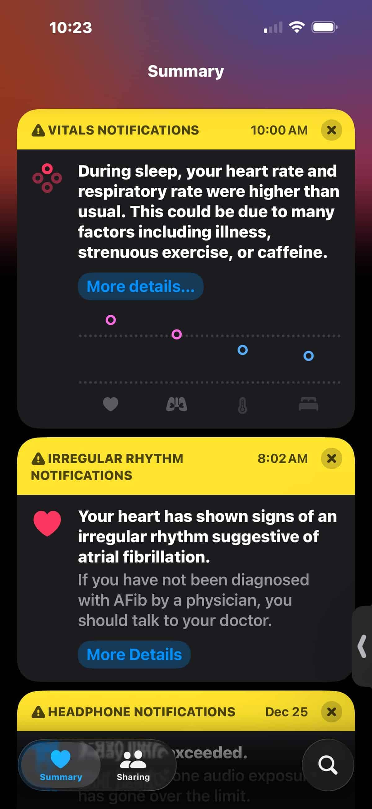Alerta de ritmo irregular do Apple Watch