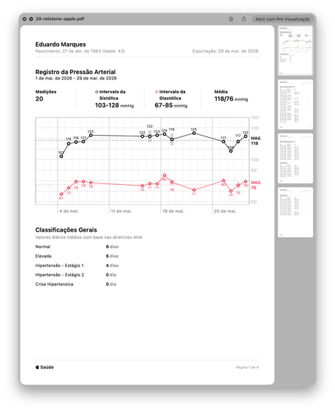 BPM Vision